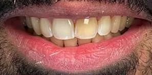 Before
