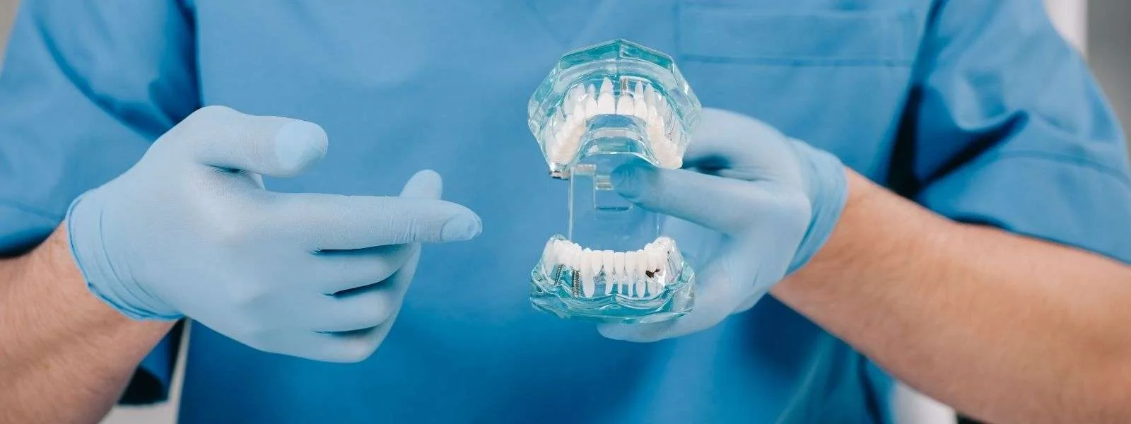 Did You Know There Are 2 Types of Dental Implants?