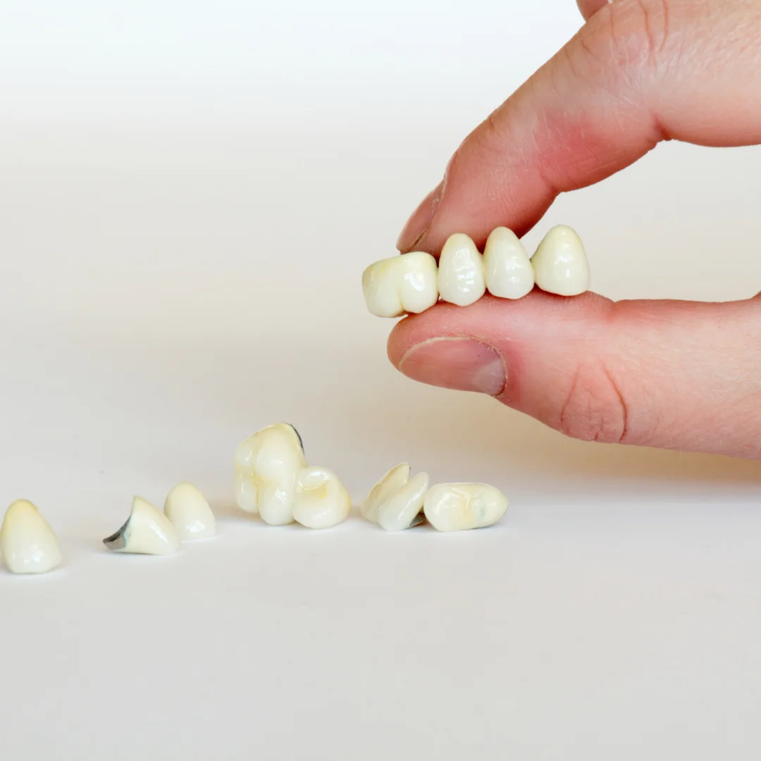 Dental crowns and bridges at Glendale Dental Wellness