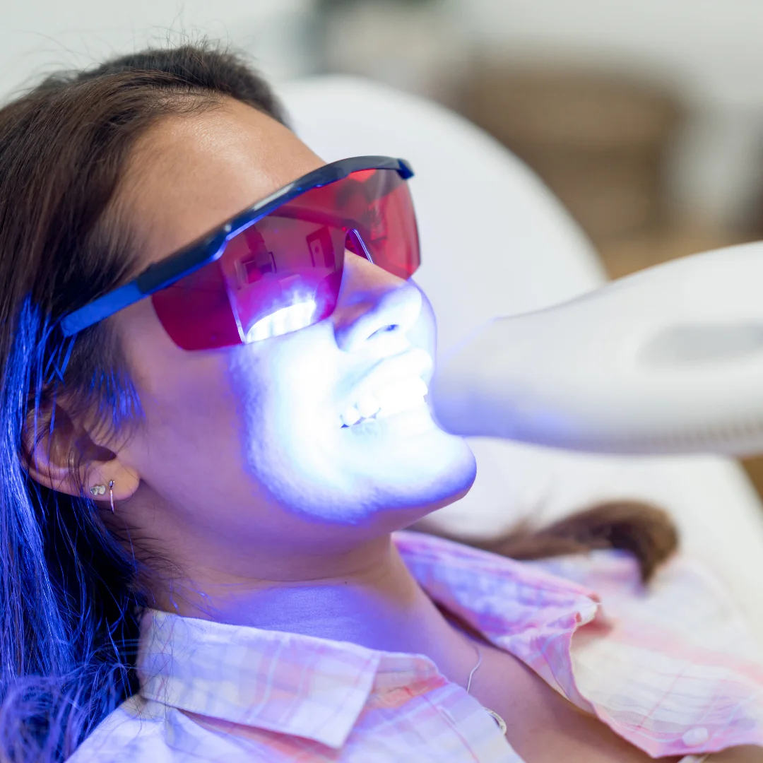 Zoom teeth whitening at Glendale Dental Wellness